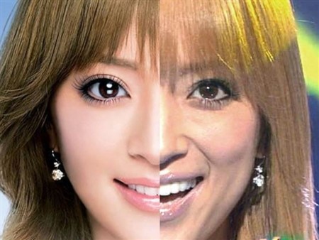 芸能人 整形失敗