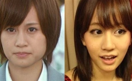 芸能人 整形失敗