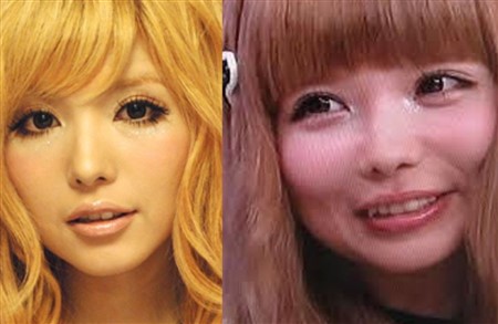 芸能人 整形失敗