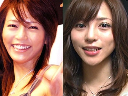 芸能人 整形失敗