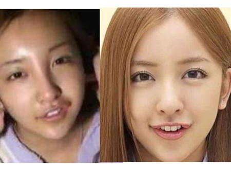 芸能人 すっぴん