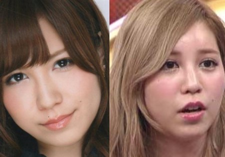 芸能人 整形失敗