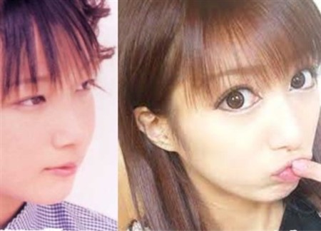 芸能人 整形失敗