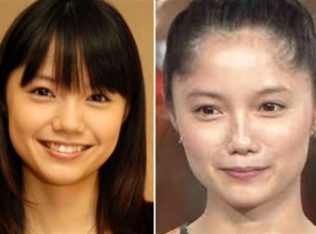 芸能人 整形失敗